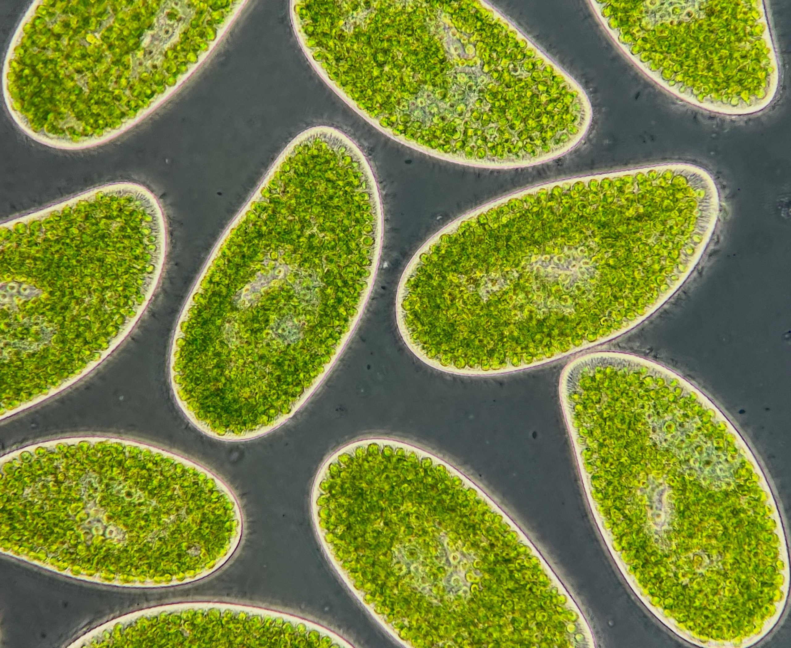 Des microbes inconnus peuvent être un signal d&rsquo;alerte précoce d&rsquo;un point de basculement climatique